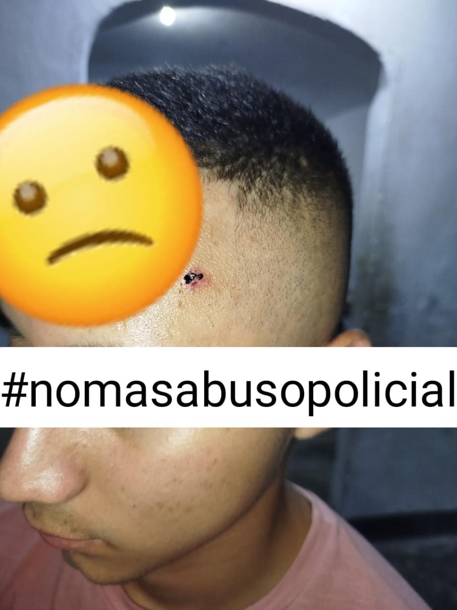 Presunto abuso de autoridad