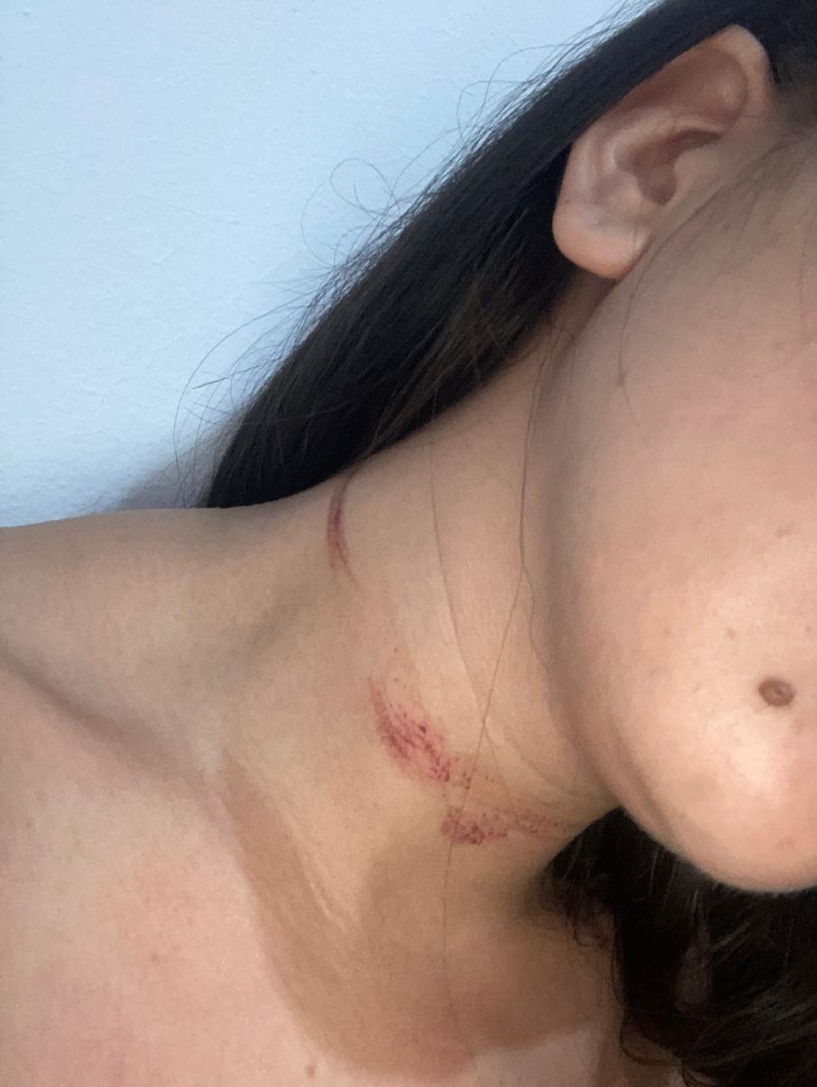 Cuello
