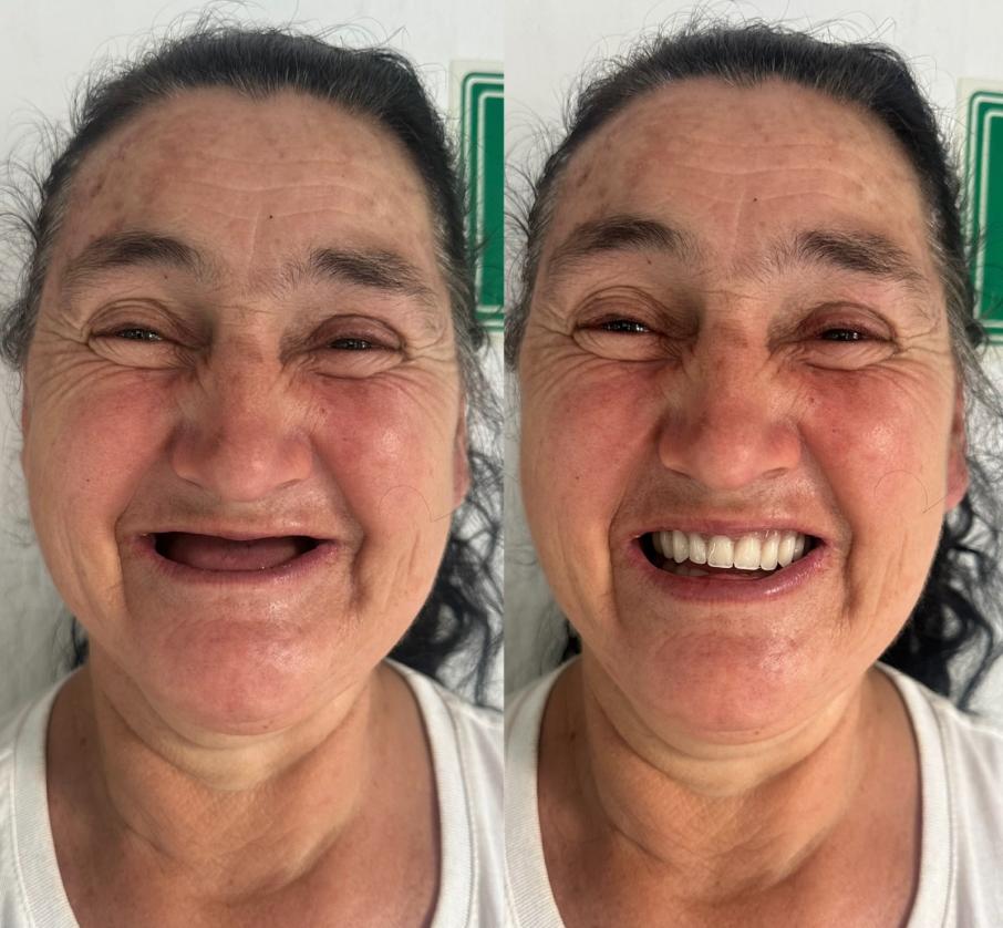 Operación Sonrisas