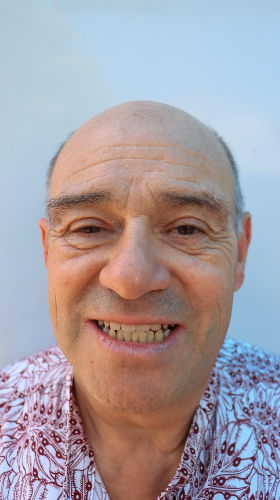 Operacion sonrisa