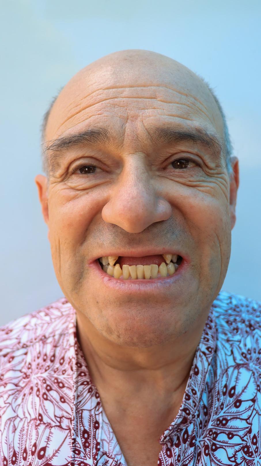 Operacion sonrisa