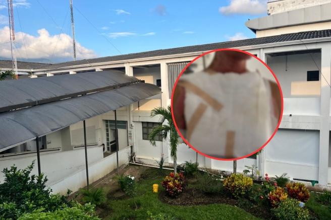 Quemados por pólvora en Ibagué