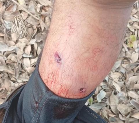 joven_herido_chaparral